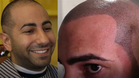 August 26, 2022 The H3Podcast reacts to fouseyTUBE's speech and they discover their new favorite sound bite "I felt ugly, I felt worthless, I felt gay-no. . Fouseytube hairline